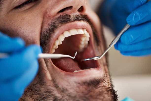 Best Emergency Denture Repair in Crystal Lake, CT